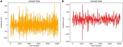 Advanced framework for epilepsy detection through image-based EEG signal analysis